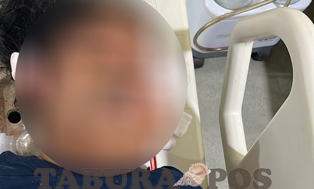 Laka Lantas di Sowi Akibat Pengendara Motor Dipengaruhi Minuman Beralkohol
